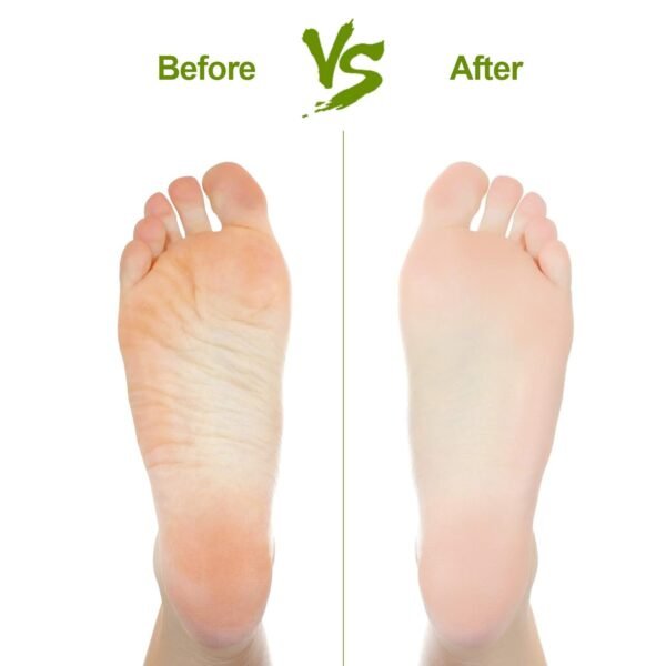 rectangular foot pumice stone for dead skin & callus removal (1 pc)