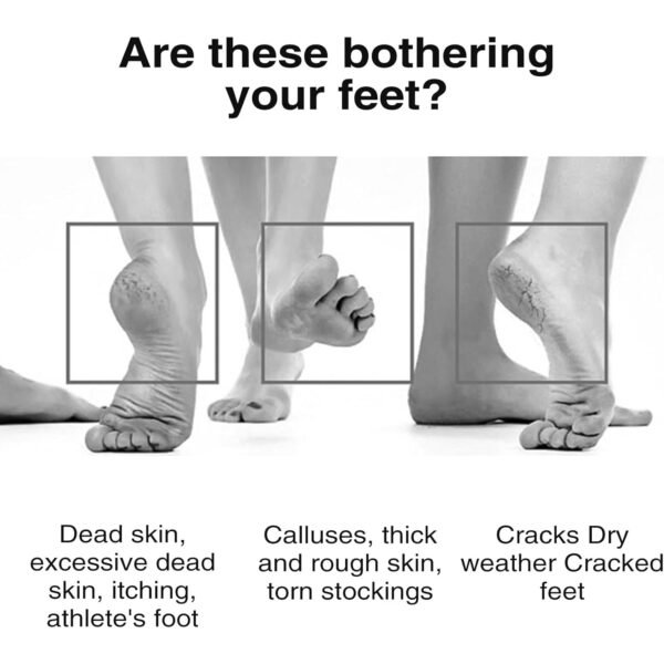 rectangular foot pumice stone for dead skin & callus removal (1 pc)